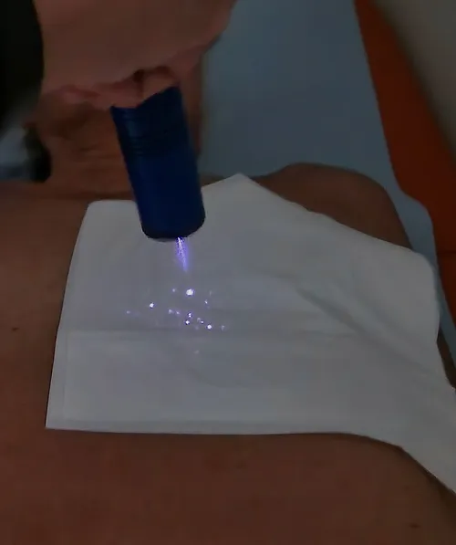 Energetic Corrector Beispiele für das Leuchten der Punkte bei Menschen 3